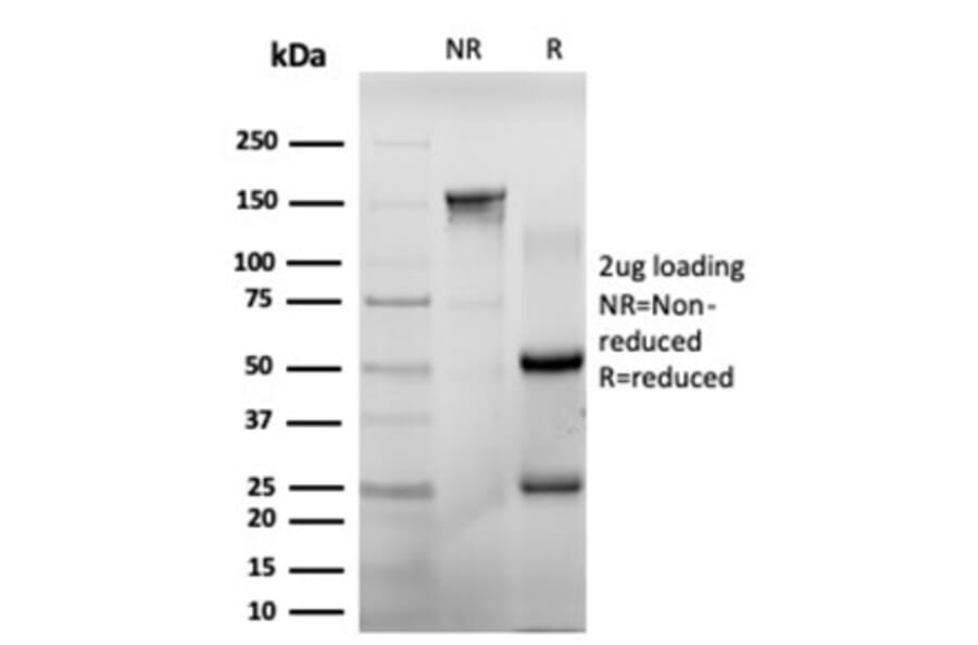 SDS-PAGE - Anti-CHEK2 Antibody [PCRP-CHEK2-1A4] (A277540) - Antibodies.com