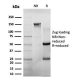 SDS-PAGE - Anti-CHEK2 Antibody [PCRP-CHEK2-1A4] (A277540) - Antibodies.com