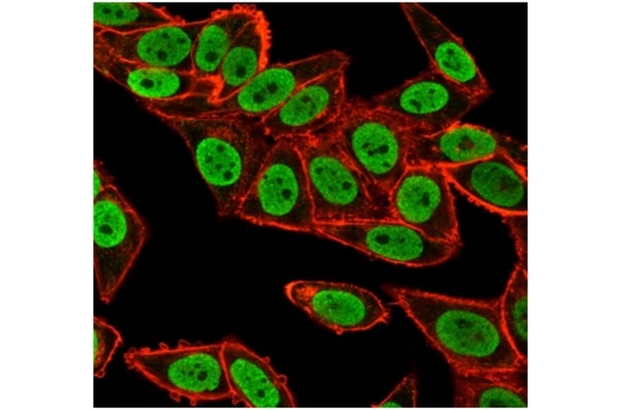 Immunofluorescence - Anti-CHEK2 Antibody [PCRP-CHEK2-1A4] (A277540) - Antibodies.com