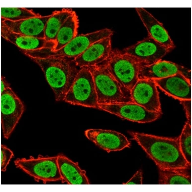 Immunofluorescence - Anti-CHEK2 Antibody [PCRP-CHEK2-1A4] (A277540) - Antibodies.com
