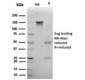 SDS-PAGE - Anti-KLF12 Antibody [PCRP-KLF12-1E3] (A277541) - Antibodies.com