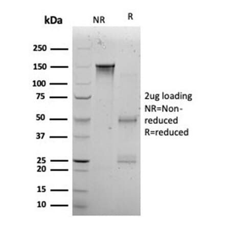 SDS-PAGE - Anti-KLF12 Antibody [PCRP-KLF12-1E3] (A277541) - Antibodies.com