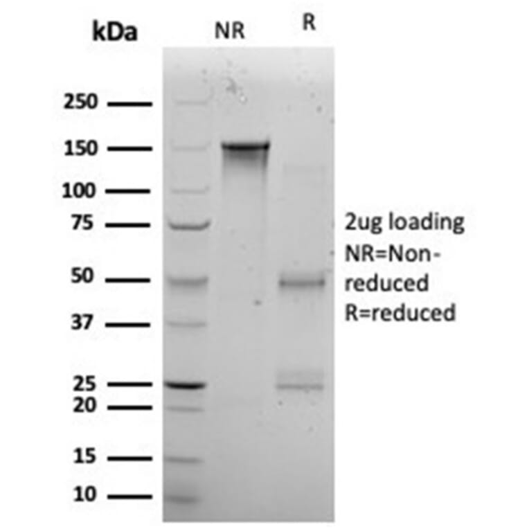 SDS-PAGE - Anti-KLF12 Antibody [PCRP-KLF12-1E3] (A277541) - Antibodies.com