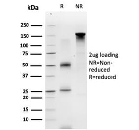 SDS-PAGE - Anti-ECD Antibody [PCRP-ECD-1D10] (A277542) - Antibodies.com