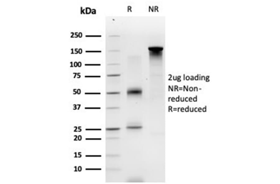 SDS-PAGE - Anti-ECD Antibody [PCRP-ECD-1D10] (A277542) - Antibodies.com