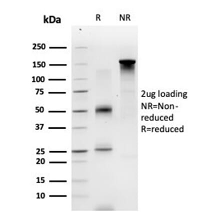 SDS-PAGE - Anti-ECD Antibody [PCRP-ECD-1D10] (A277542) - Antibodies.com