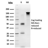 SDS-PAGE - Anti-ECD Antibody [PCRP-ECD-1D10] (A277542) - Antibodies.com