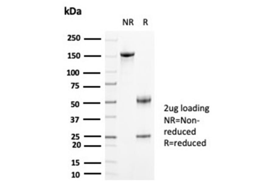SDS-PAGE - Anti-Creatine Kinase BB Antibody [CKBB/6871] (A277543) - Antibodies.com
