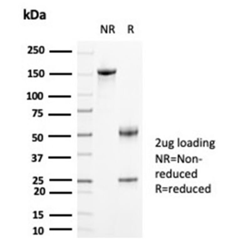 SDS-PAGE - Anti-Creatine Kinase BB Antibody [CKBB/6871] (A277543) - Antibodies.com