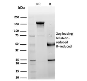 SDS-PAGE - Anti-LRG1 Antibody [LRG1/4882] (A277544) - Antibodies.com