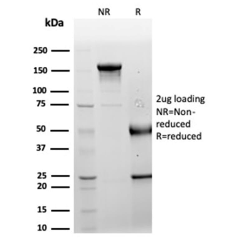 SDS-PAGE - Anti-LRG1 Antibody [LRG1/4882] (A277544) - Antibodies.com