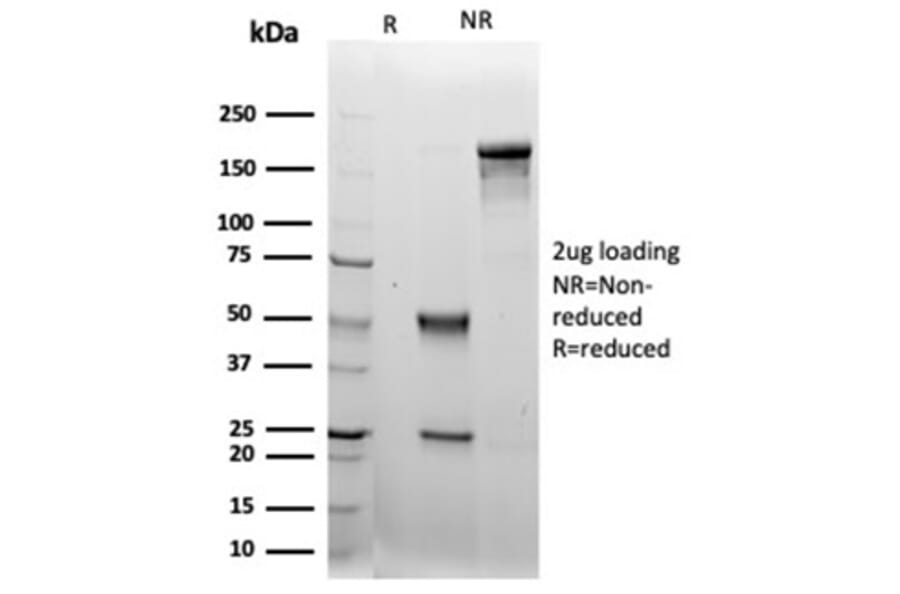 SDS-PAGE - Anti-LRG1 Antibody [LRG1/4883] (A277545) - Antibodies.com