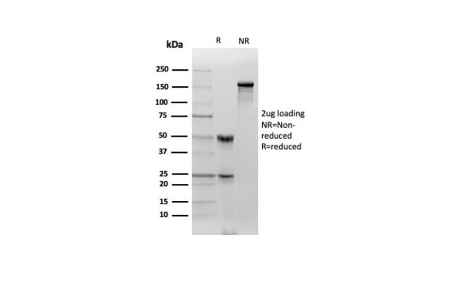 SDS-PAGE - Anti-Clusterin Antibody [CLU/4730] (A277547) - Antibodies.com