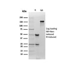 SDS-PAGE - Anti-Clusterin Antibody [CLU/4730] (A277547) - Antibodies.com