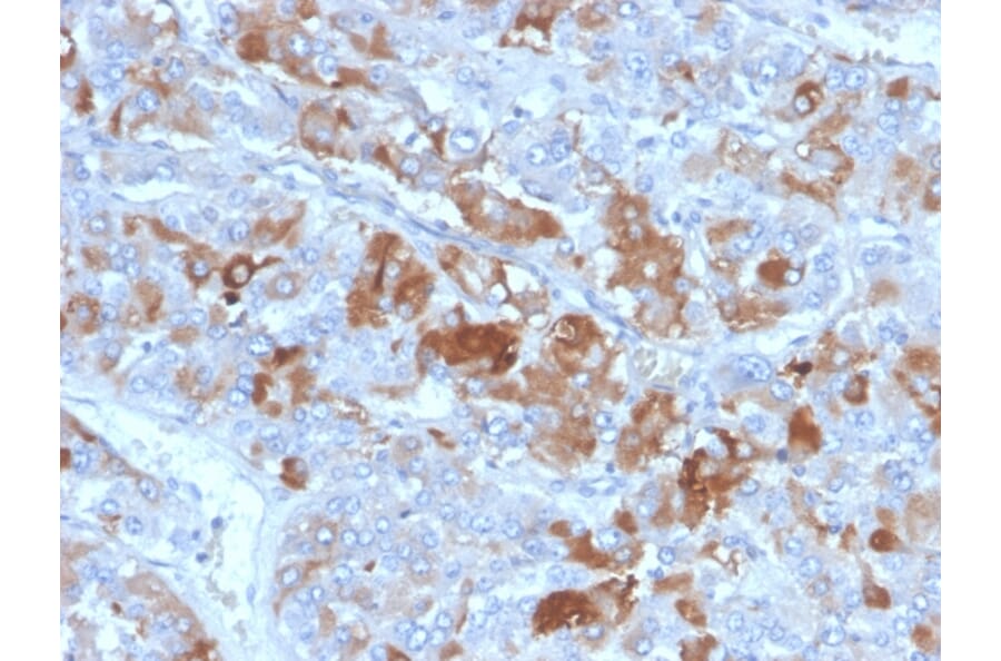 Immunohistochemistry - Anti-Clusterin Antibody [CLU/4731] (A277548) - Antibodies.com