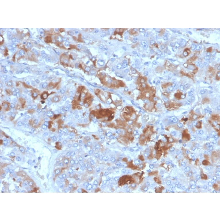 Immunohistochemistry - Anti-Clusterin Antibody [CLU/4731] (A277548) - Antibodies.com