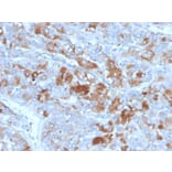 Immunohistochemistry - Anti-Clusterin Antibody [CLU/4731] (A277548) - Antibodies.com