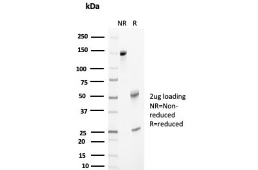 SDS-PAGE - Anti-Clusterin Antibody [CLU/4733] (A277549) - Antibodies.com