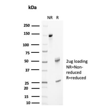 SDS-PAGE - Anti-Clusterin Antibody [CLU/4733] (A277549) - Antibodies.com