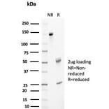 SDS-PAGE - Anti-Clusterin Antibody [CLU/4733] (A277549) - Antibodies.com