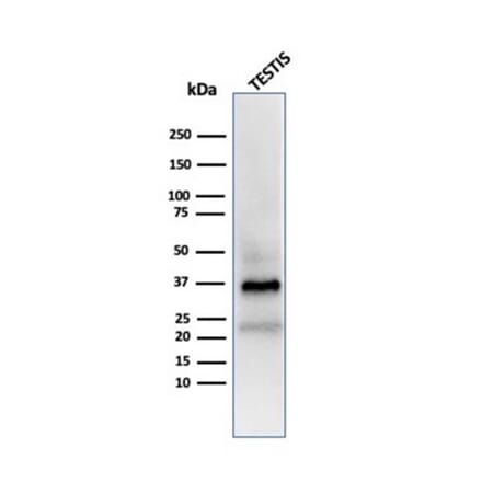 Western Blot - Anti-Clusterin Antibody [CLU/4723] (A277550) - Antibodies.com