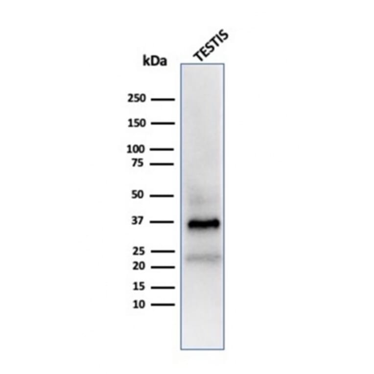 Western Blot - Anti-Clusterin Antibody [CLU/4723] (A277550) - Antibodies.com