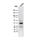 Western Blot - Anti-Clusterin Antibody [CLU/4723] (A277550) - Antibodies.com