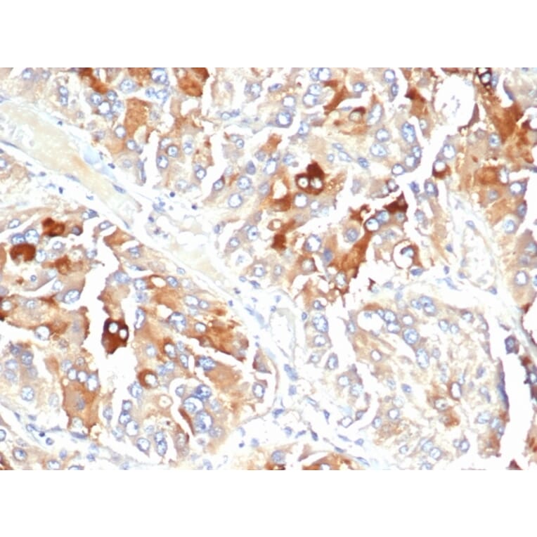 Immunohistochemistry - Anti-Clusterin Antibody [CLU/4723] (A277550) - Antibodies.com
