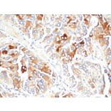 Immunohistochemistry - Anti-Clusterin Antibody [CLU/4723] (A277550) - Antibodies.com