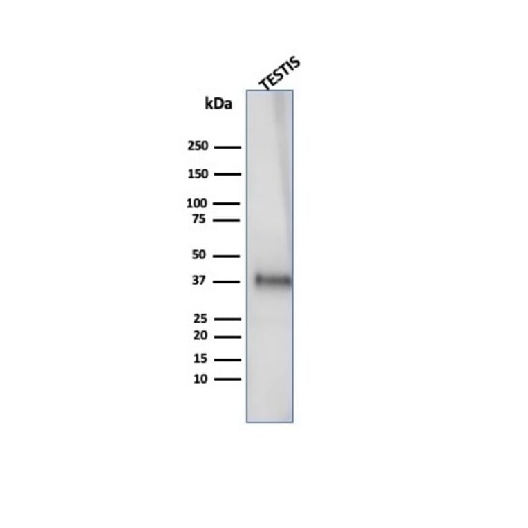 Western Blot - Anti-Clusterin Antibody [CLU/4727] (A277551) - Antibodies.com