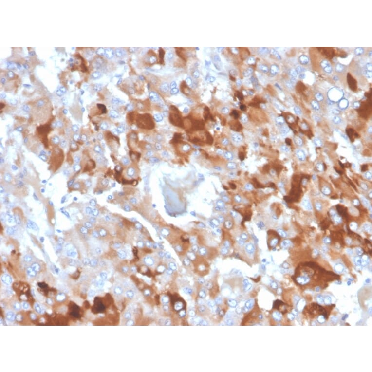 Immunohistochemistry - Anti-Clusterin Antibody [CLU/4727] (A277551) - Antibodies.com