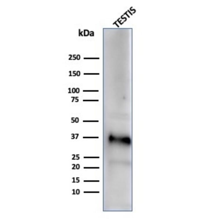 Western Blot - Anti-Clusterin Antibody [CLU/4729] (A277552) - Antibodies.com