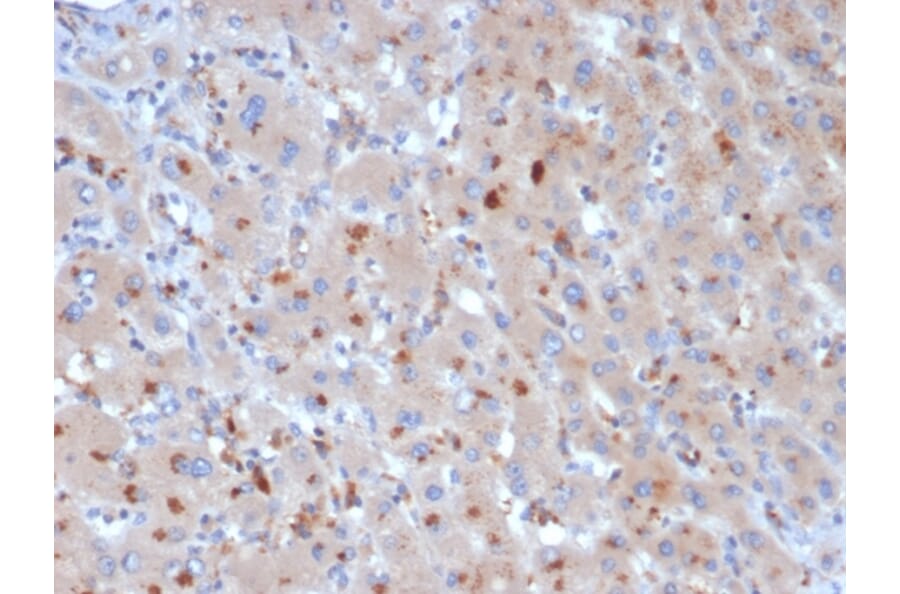 Immunohistochemistry - Anti-alpha 1 Antichymotrypsin Antibody [SERPINA3/4190] (A277553) - Antibodies.com