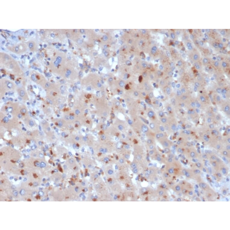 Immunohistochemistry - Anti-alpha 1 Antichymotrypsin Antibody [SERPINA3/4190] (A277553) - Antibodies.com