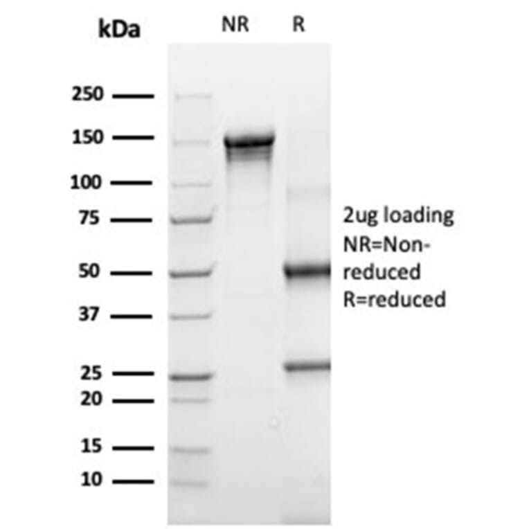 SDS-PAGE - Anti-alpha 1 Antichymotrypsin Antibody [SERPINA3/4190] (A277553) - Antibodies.com