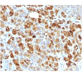 Immunohistochemistry - Anti-alpha 1 Antichymotrypsin Antibody [AACT/1451 + AACT/1452] (A277554) - Antibodies.com