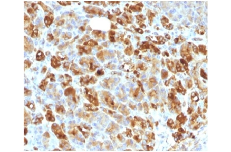 Immunohistochemistry - Anti-alpha 1 Antichymotrypsin Antibody [AACT/1451 + AACT/1452] (A277554) - Antibodies.com