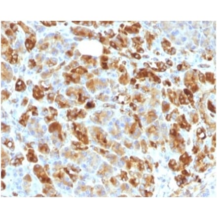 Immunohistochemistry - Anti-alpha 1 Antichymotrypsin Antibody [AACT/1451 + AACT/1452] (A277554) - Antibodies.com