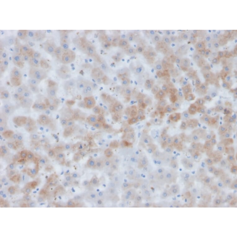 Immunohistochemistry - Anti-alpha 1 Antichymotrypsin Antibody [SERPINA3/4184] (A277555) - Antibodies.com