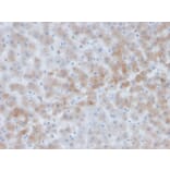 Immunohistochemistry - Anti-alpha 1 Antichymotrypsin Antibody [SERPINA3/4184] (A277555) - Antibodies.com