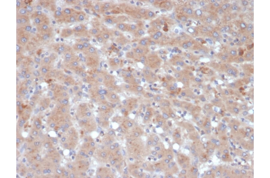 Immunohistochemistry - Anti-alpha 1 Antichymotrypsin Antibody [SERPINA3/4189] (A277558) - Antibodies.com
