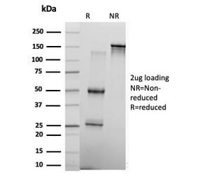 SDS-PAGE - Anti-KLF17 Antibody [PCRP-KLF17-1G2] (A277559) - Antibodies.com