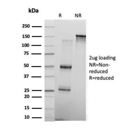 SDS-PAGE - Anti-KLF17 Antibody [PCRP-KLF17-1G2] (A277559) - Antibodies.com