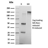 SDS-PAGE - Anti-KLF17 Antibody [PCRP-KLF17-1G2] (A277559) - Antibodies.com