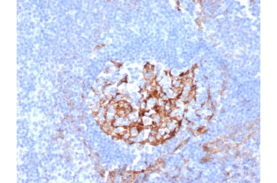 Immunohistochemistry - Anti-CD35 Antibody [CR1/6380] (A277560) - Antibodies.com