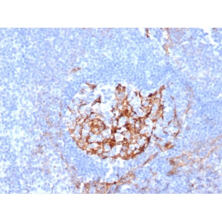 Immunohistochemistry - Anti-CD35 Antibody [CR1/6380] (A277560) - Antibodies.com