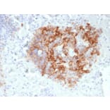 Immunohistochemistry - Anti-CD35 Antibody [CR1/6380] (A277560) - Antibodies.com