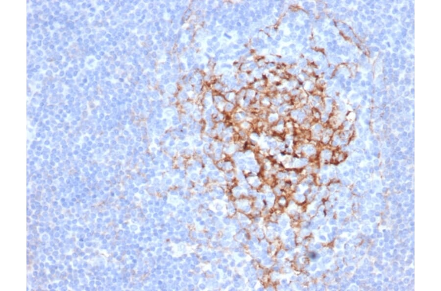 Immunohistochemistry - Anti-CD35 Antibody [CR1/6383] (A277561) - Antibodies.com