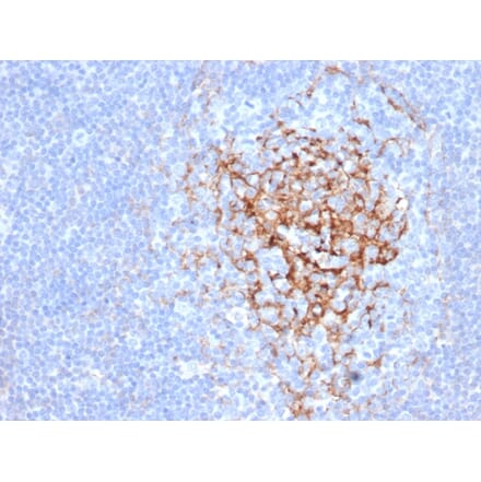 Immunohistochemistry - Anti-CD35 Antibody [CR1/6383] (A277561) - Antibodies.com