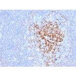 Immunohistochemistry - Anti-CD35 Antibody [CR1/6383] (A277561) - Antibodies.com